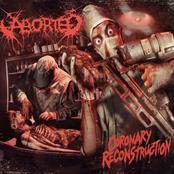 ABORTED - Coronary Reconstruction cover 