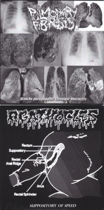 AGATHOCLES - Broncho-Pneumopathie Chronique Obstructive / Suppository of Speed cover 