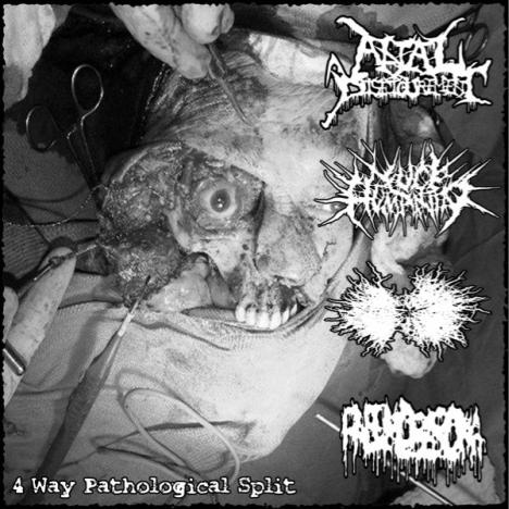 ANAL DISFIGUREMENT - 4 Way Pathological Split cover 