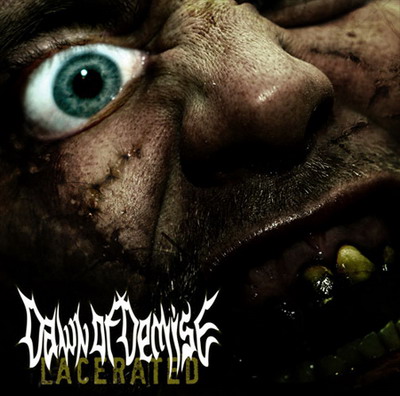 DAWN OF DEMISE - Lacerated cover 