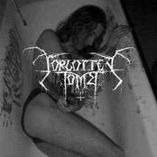 FORGOTTEN TOMB - Songs to Leave cover 