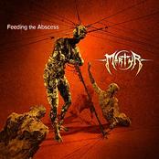 MARTYR - Feeding the Abscess cover 