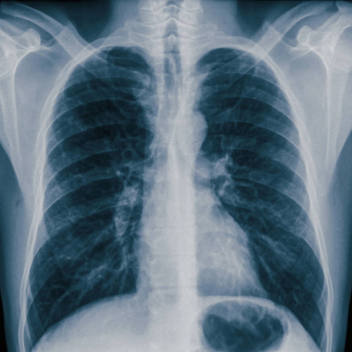 OPIUM WARLOCK - Lung cover 