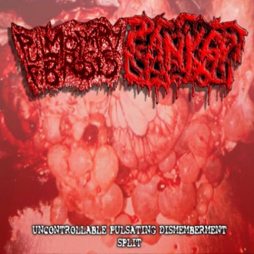 PULMONARY FIBROSIS - Uncontrollable Pulsating Dismemberment Split cover 