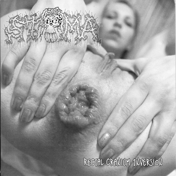 STOMA - Methadone Abortion Clinic / Rectal Cranium Inversion cover 