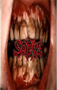 SUTURE - Bloodsoaked cover 