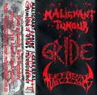 CEREBRAL TURBULENCY Malignant Tumour / Gride / Cerebral Turbulency album cover