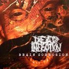 DEAD INFECTION Brain Corrosion album cover