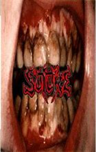 SUTURE Bloodsoaked album cover