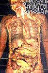 VÔMITO - Anatomical Pathology cover 