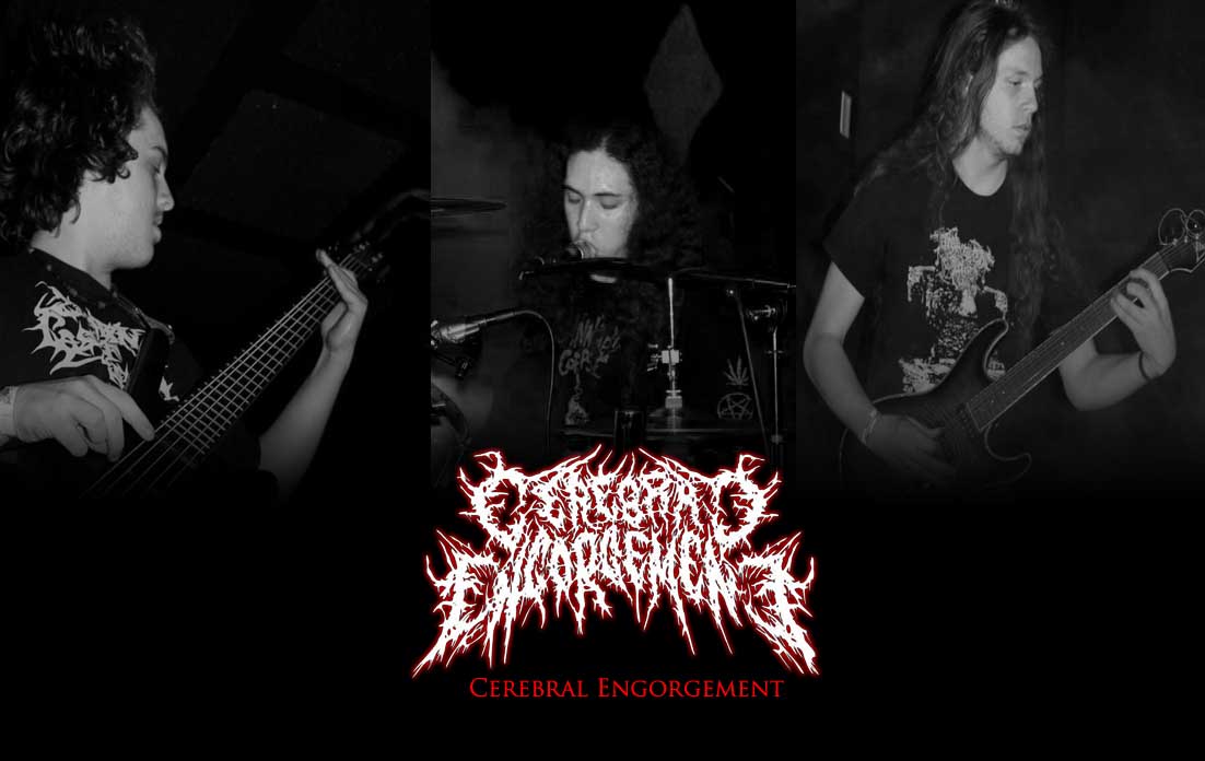 CEREBRAL ENGORGEMENT picture