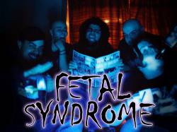 FETAL SYNDROME picture