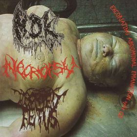 ABORTED FETUS - Excoriating Abdominal Emanation cover 
