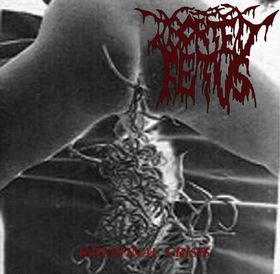 ABORTED FETUS - Intestinal Crisis cover 