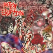 ARTERY ERUPTION - Gouging Out Eyes of Mutilated Infants cover 