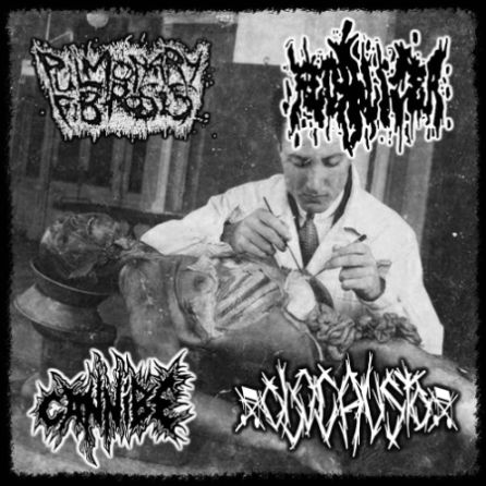 CANNIBE - Pulmonary Fibrosis / Fecalizer / Cannibe / Olocausto cover 