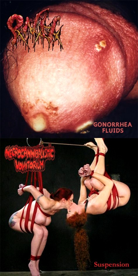 NECROCANNIBALISTIC VOMITORIUM - Gonorrhea Fluids / Suspension cover 