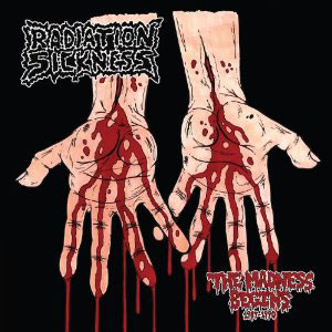 RADIATION SICKNESS - The Madness Begins 1987-1990 cover 