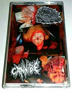 CANNIBE Botched Anastomosis J-Pouch / Cannibe album cover