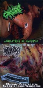 CANNIBE Laboratorio de anatomía / Chronic Progressive Subcutaneous Gangrene album cover