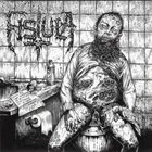 FISTULA (OH) Fistula / Hemdale Split 7