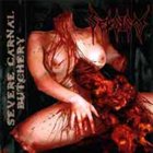 SEPSISM Severe Carnal Butchery album cover