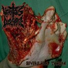 VOMITOUS DISCHARGE Severe Head Trauma album cover