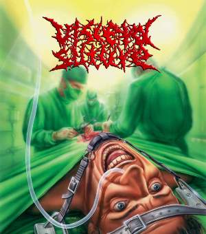 VISCERAL SUTURE - Visceral Suture cover 